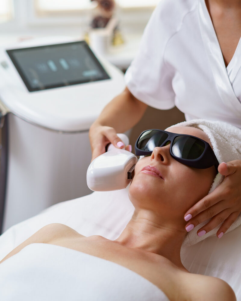 Tratamento de melasma a laser em consultório dermatológico